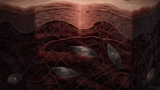 Más actividad de los fibroblastos