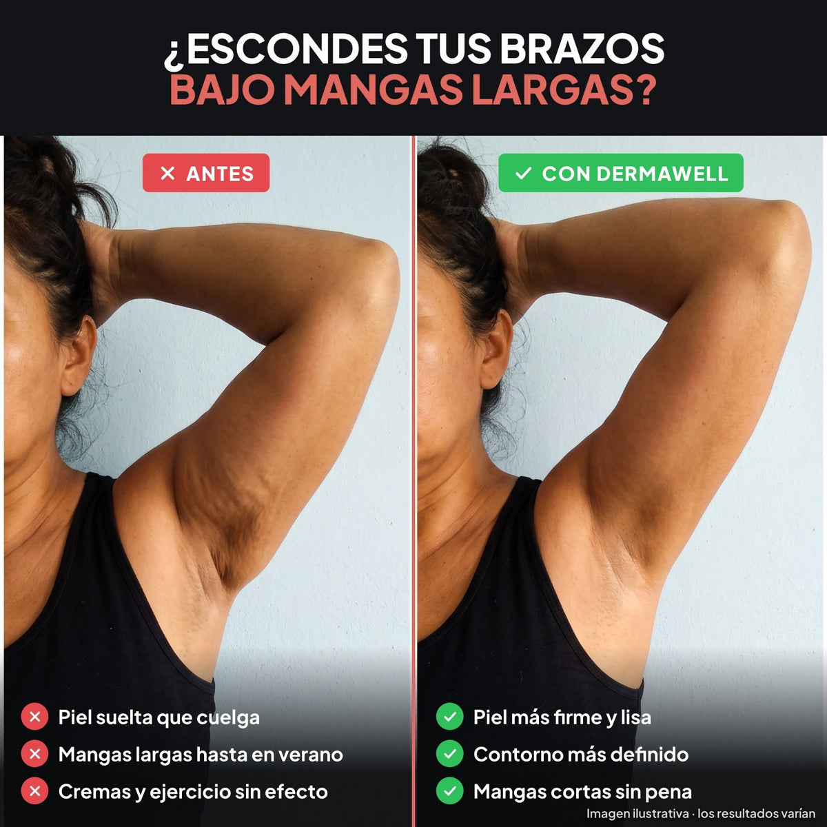 Dermawell reductor de flacidez de brazos